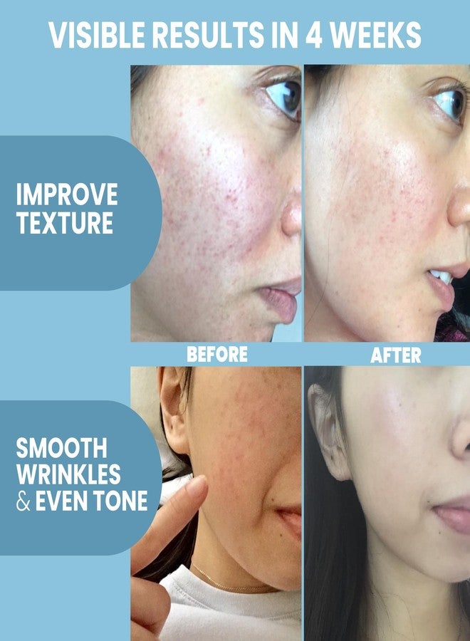 إيفا ناتشورالز مجموعة سيروم إيفا ناتشورالز ببتيد كومبلكس + ديرما رولر بإبر دقيقة - أداة ديرما تيتانيوم 0.25 مم للوجه وفروة الرأس مع سيروم ببتيد للوجه وديرما رولر - Image 3